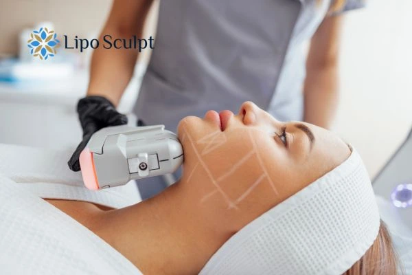 HIFU vs Botulinum Toxin: Understanding the Differences 1 HIFU vs Botox Uxbridge What is the best option for you?