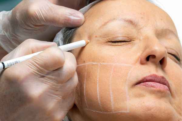 CryoPen: 5 Skin Concerns It May Be Used to Treat 4 What should you ask before having CryoPen treatment Uxbridge?